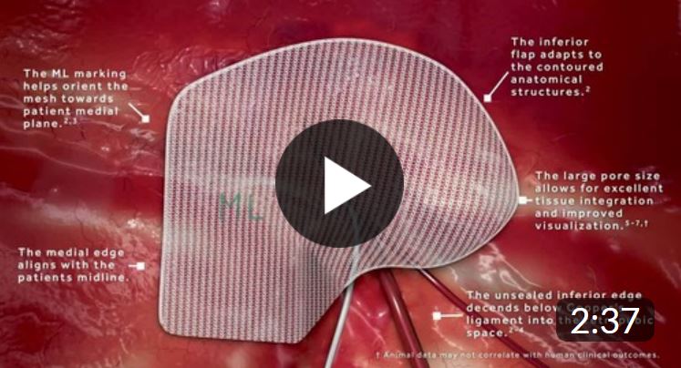 Medtronic | Dextile™ Hernia Mesh